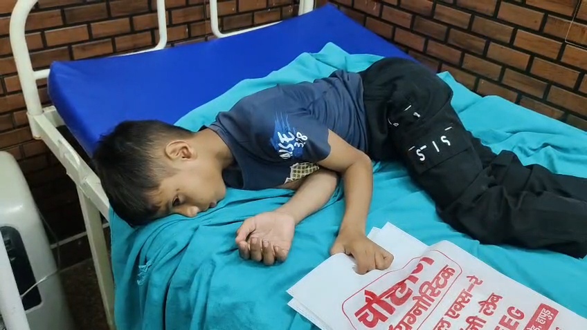 बिजली के तारों में आग से बड़ा हादसा, करंट लगने से 7 वर्षीय मासूम गंभीर